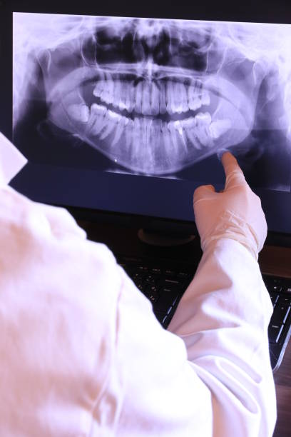 Best Emergency Dental Care for Broken or Chipped Teeth in Sewell, NJ